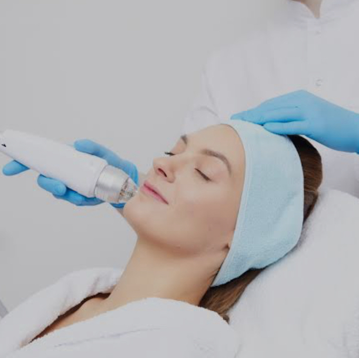 Микроигольчатый RF-лифтинг  ( лицо , подбородок)