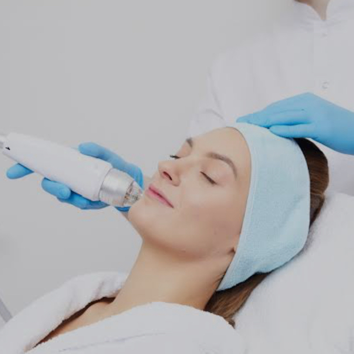 Микроигольчатый RF-лифтинг  (Лицо , шея )