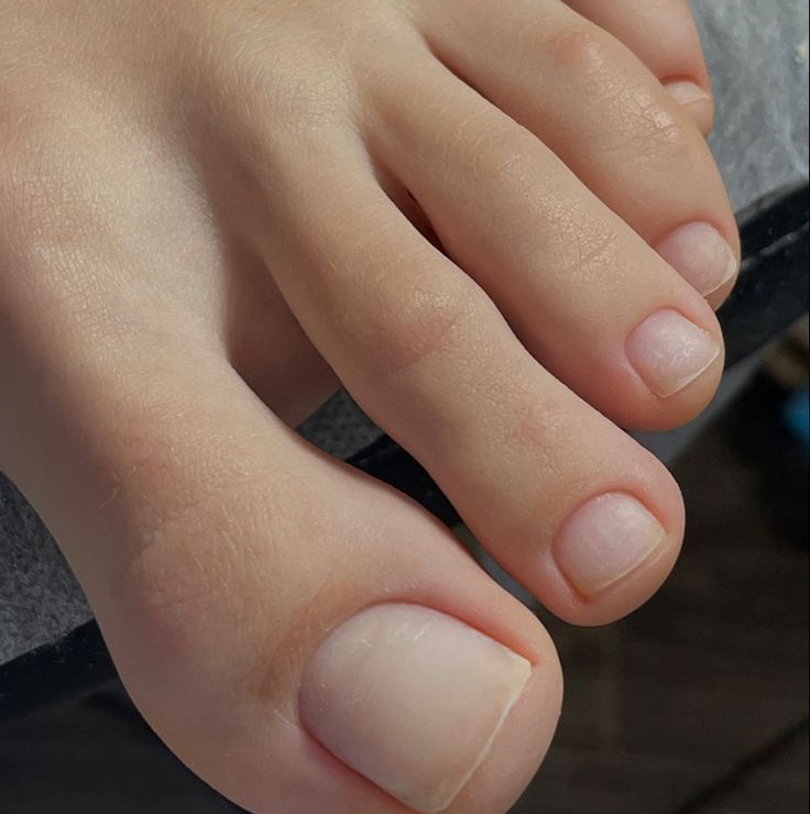 Смарт педикюр