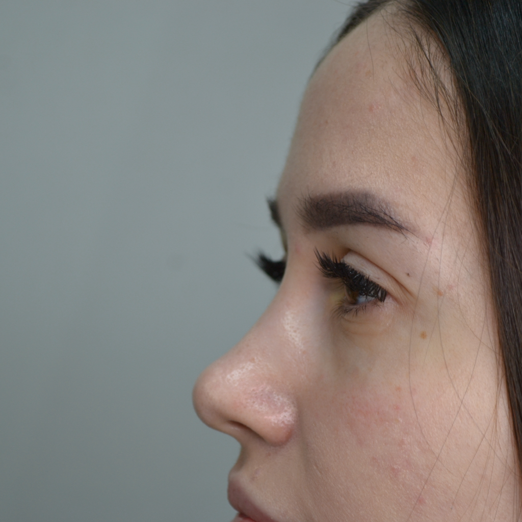 2,5-3д наращивание