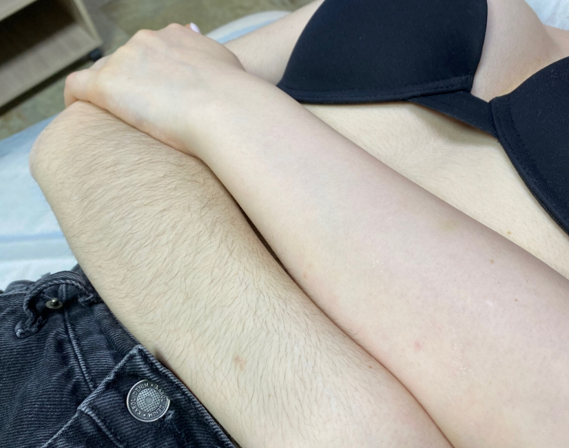 Руки до локтя