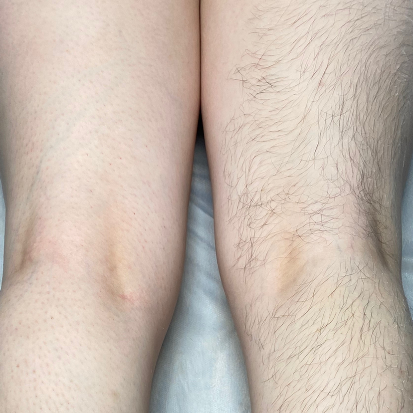 Бёдра + колено