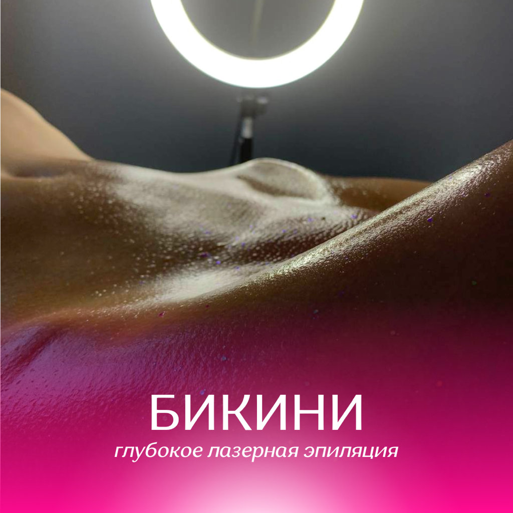 Глубокое бикини (лазер)