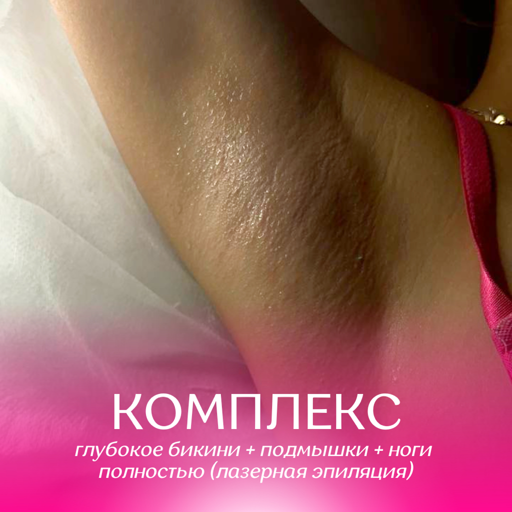 Глубокое бикини + подмышки + ноги полностью (лазер)