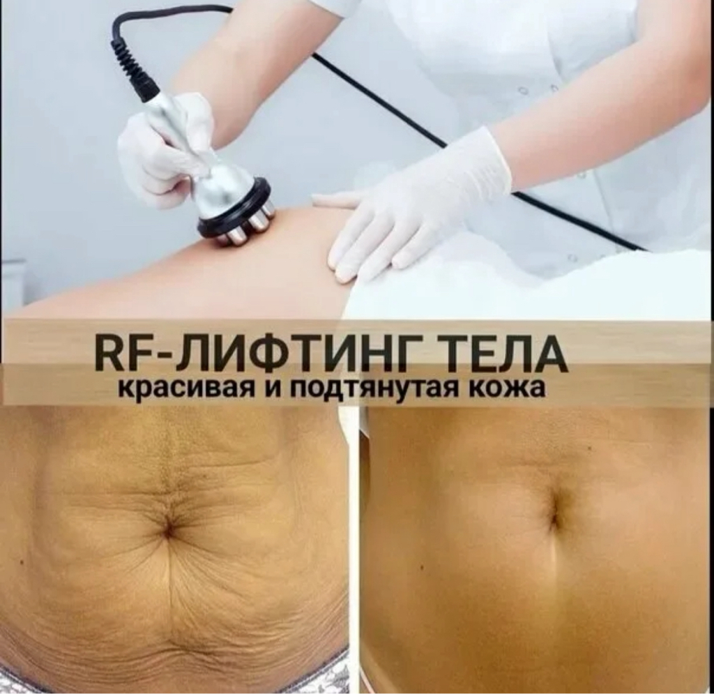 RF лифтинг
