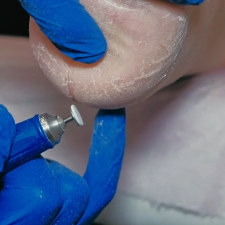 Обработка трещин ( обработка + разгрузка)