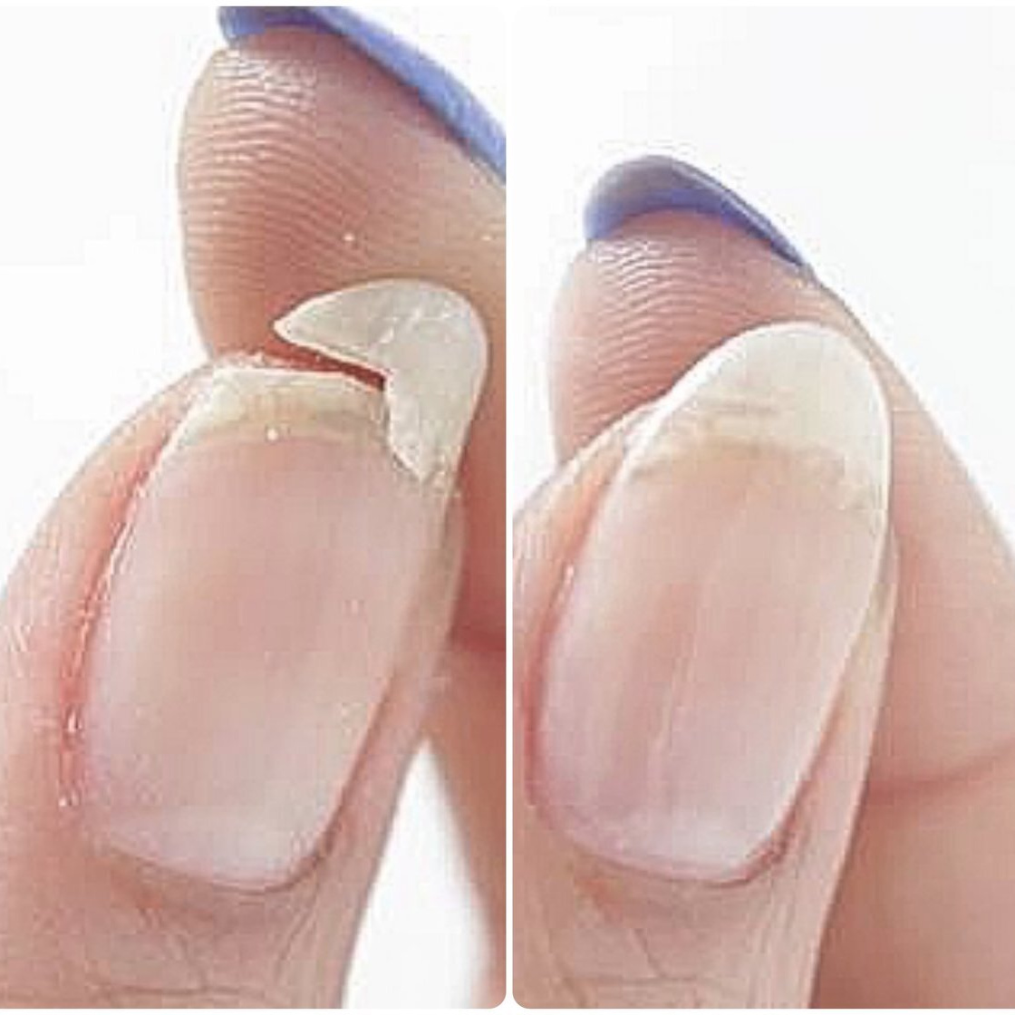 Ремонт ногтя