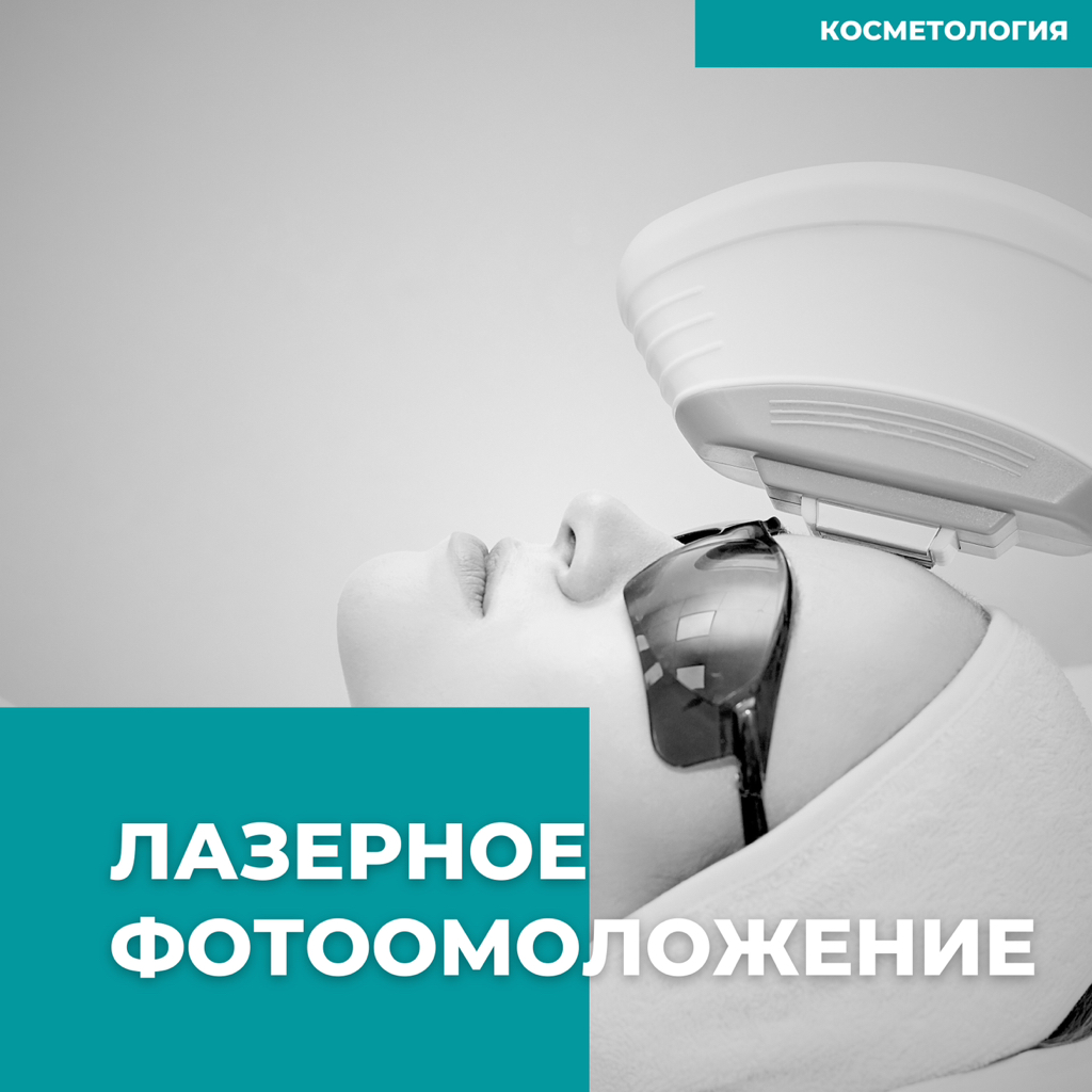New! Лазерное фотоомоложение лица
