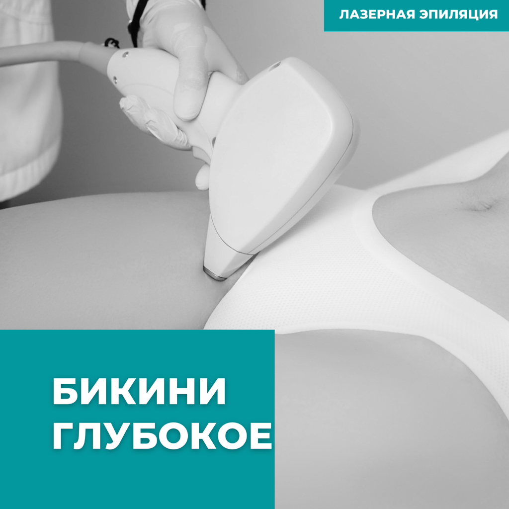 Бикини глубокое