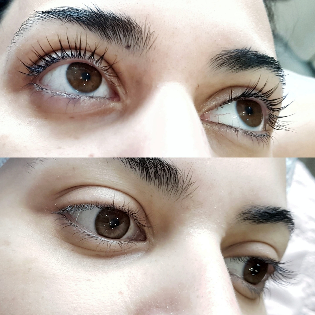 ботокс ресниц