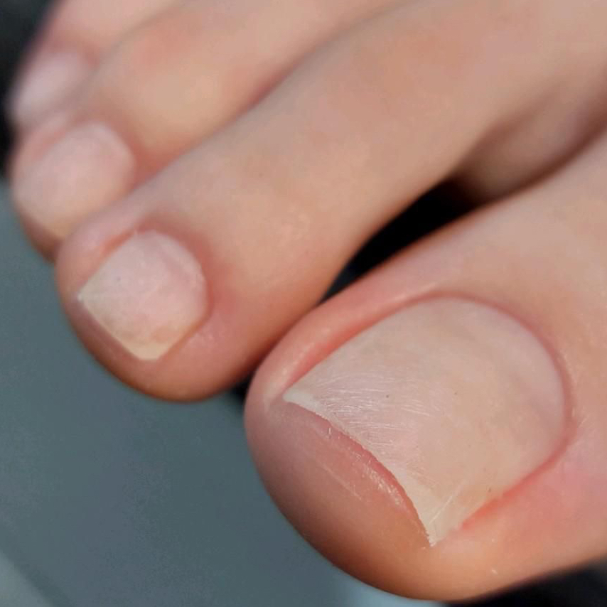 Комплекс - Гигиенический