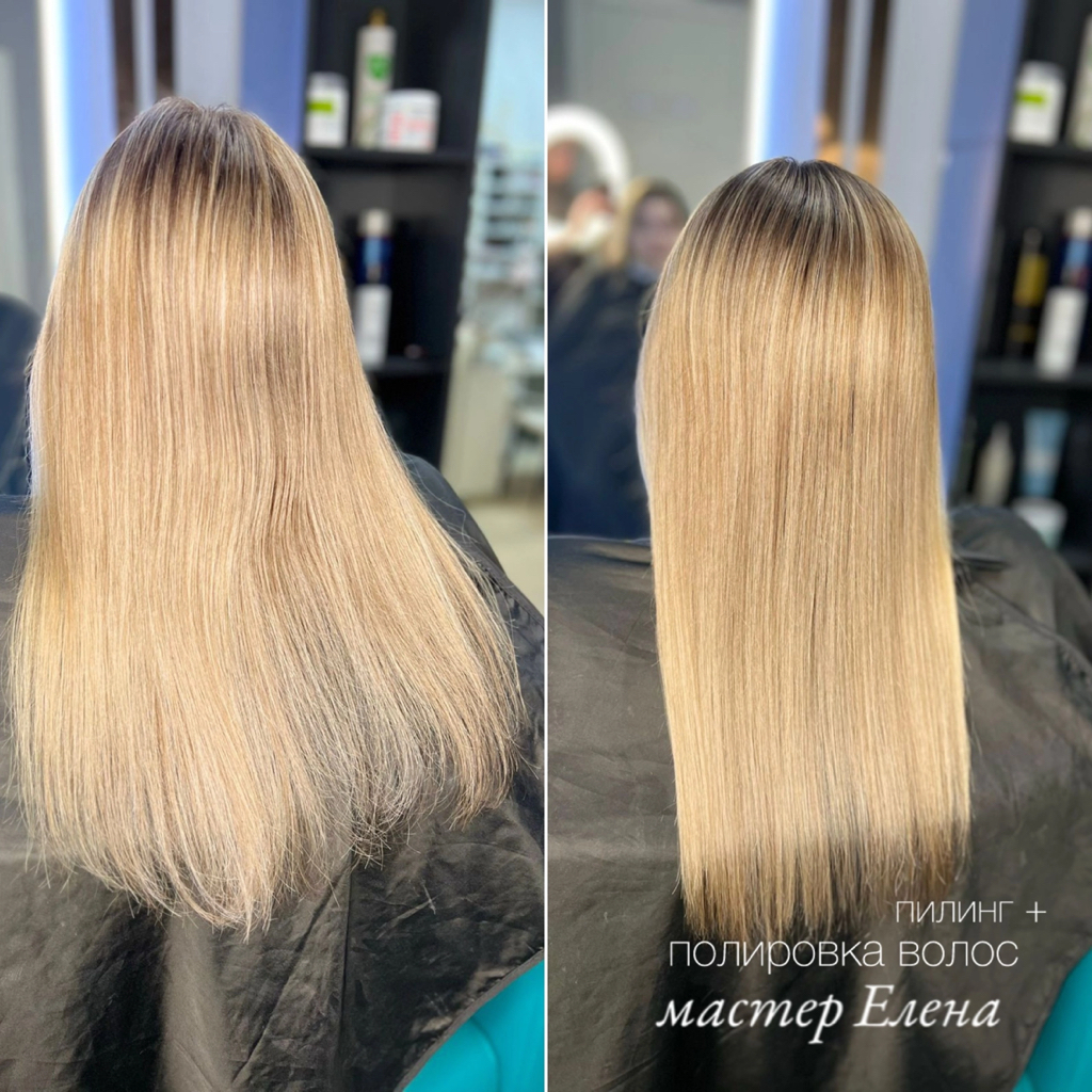 Пилинг кожи головы