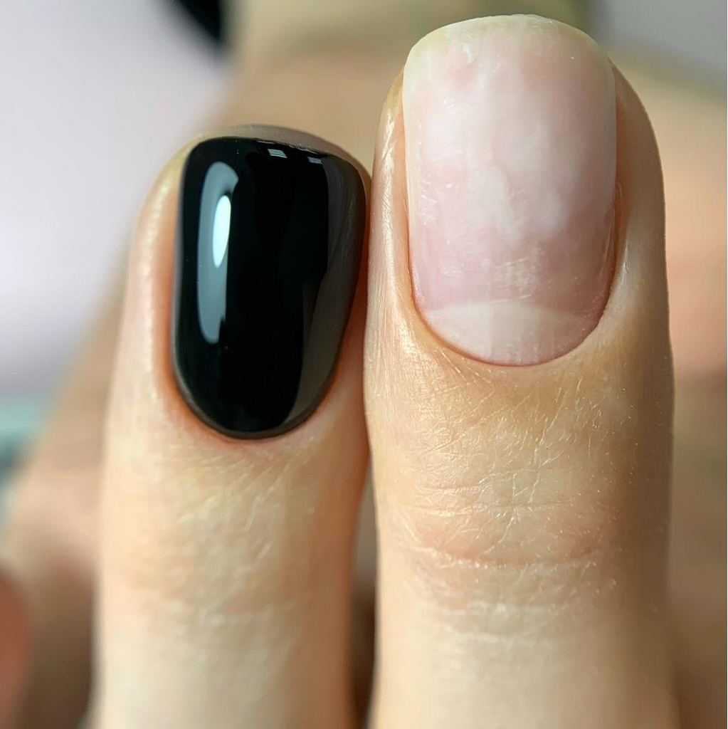 Ремонт ногтя