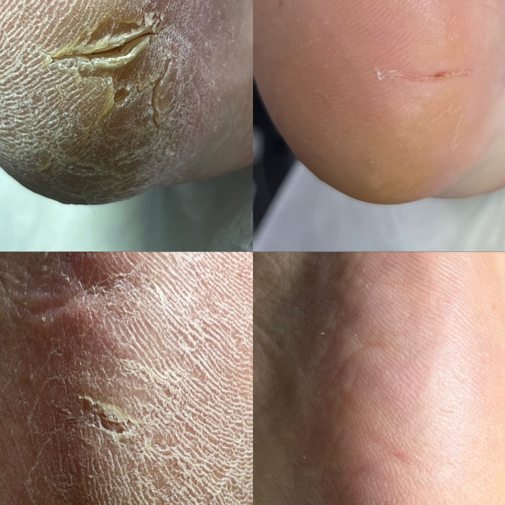 Препаратно-аппаратный педикюр  ( обработка стоп и пальчиков + покрытие гель лак)