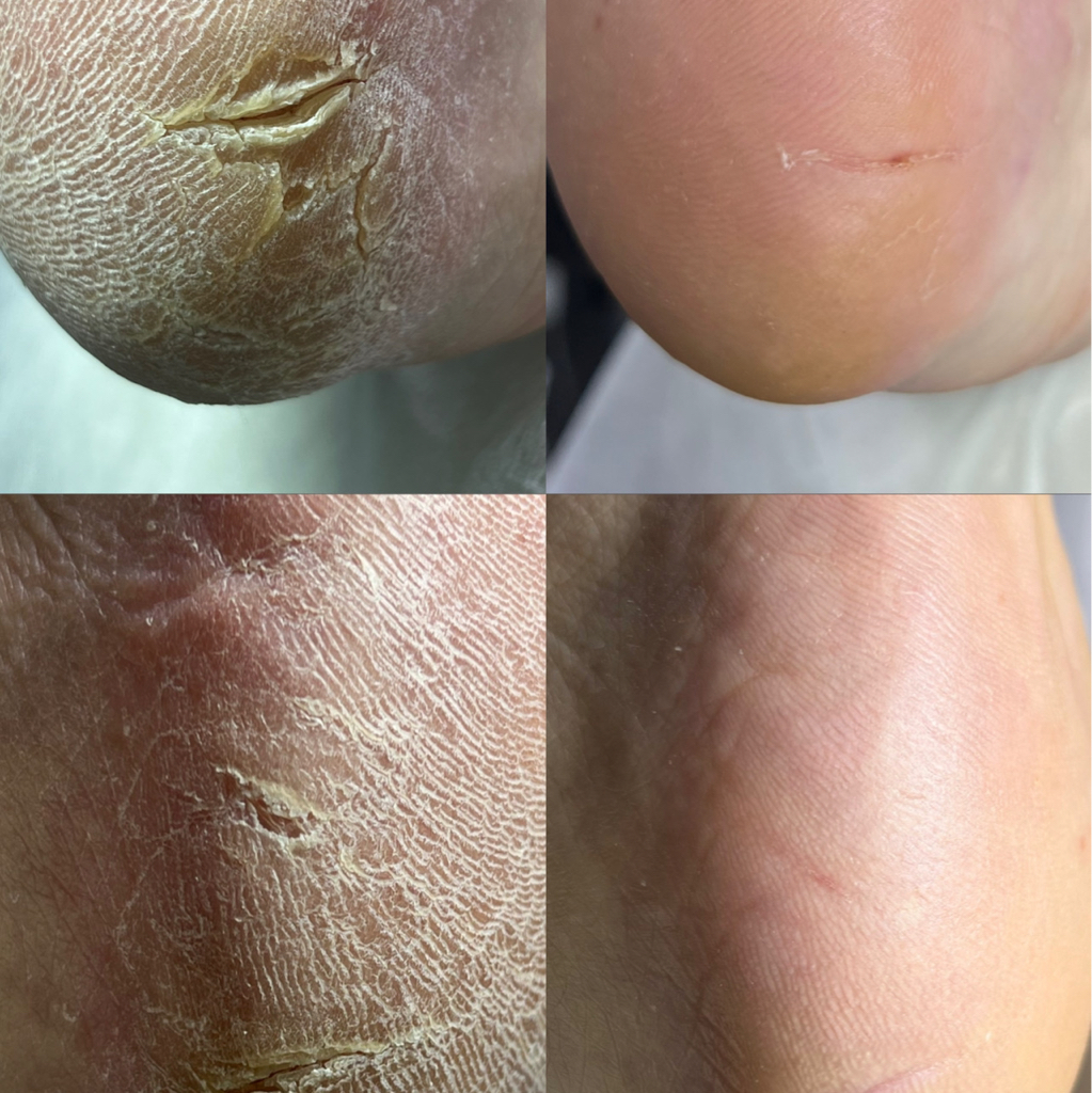 Препаратно-аппаратный педикюр ( обработка стопы и пальчиков без покрытия)