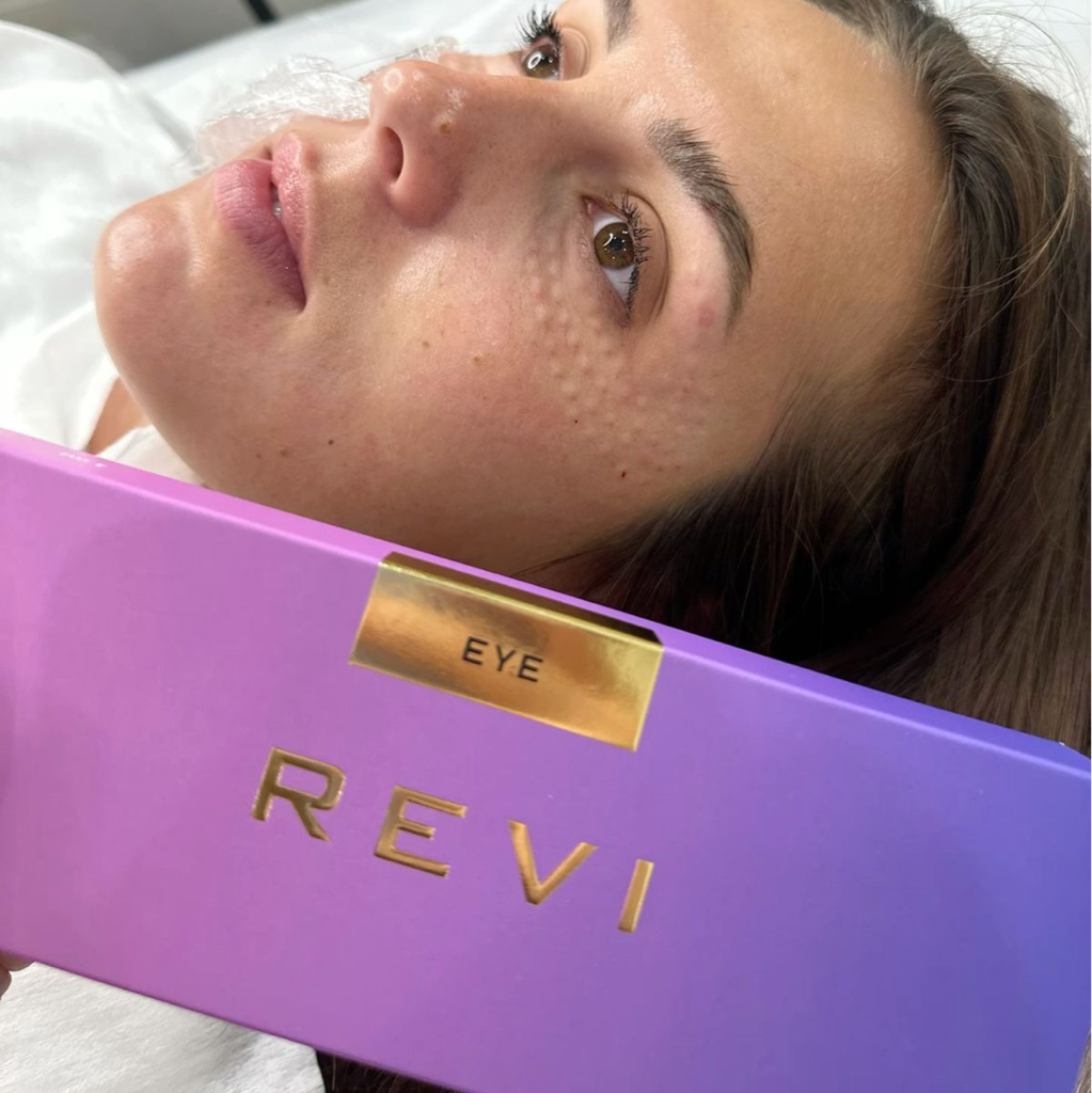 Мезотерапия препаратом «Revi eye»