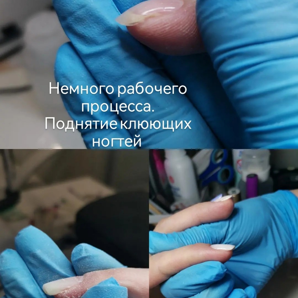 Наращивание ногтя
Поднятие клюющих ногтей
1 ноготь