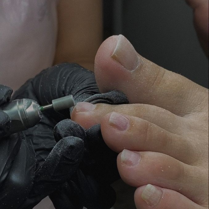 Снятие покрытия