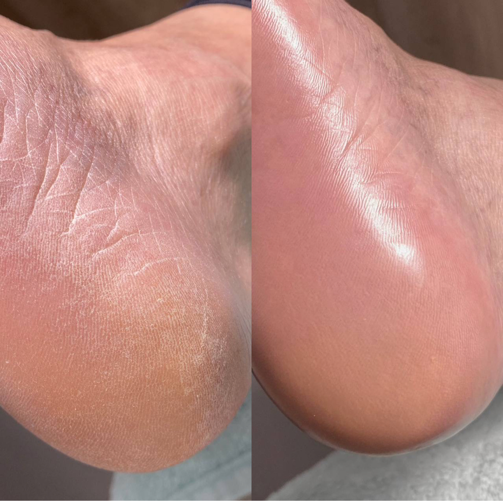 ПЕДИКЮР БЕЗ ПОКРЫТИЯ ( с пятками)