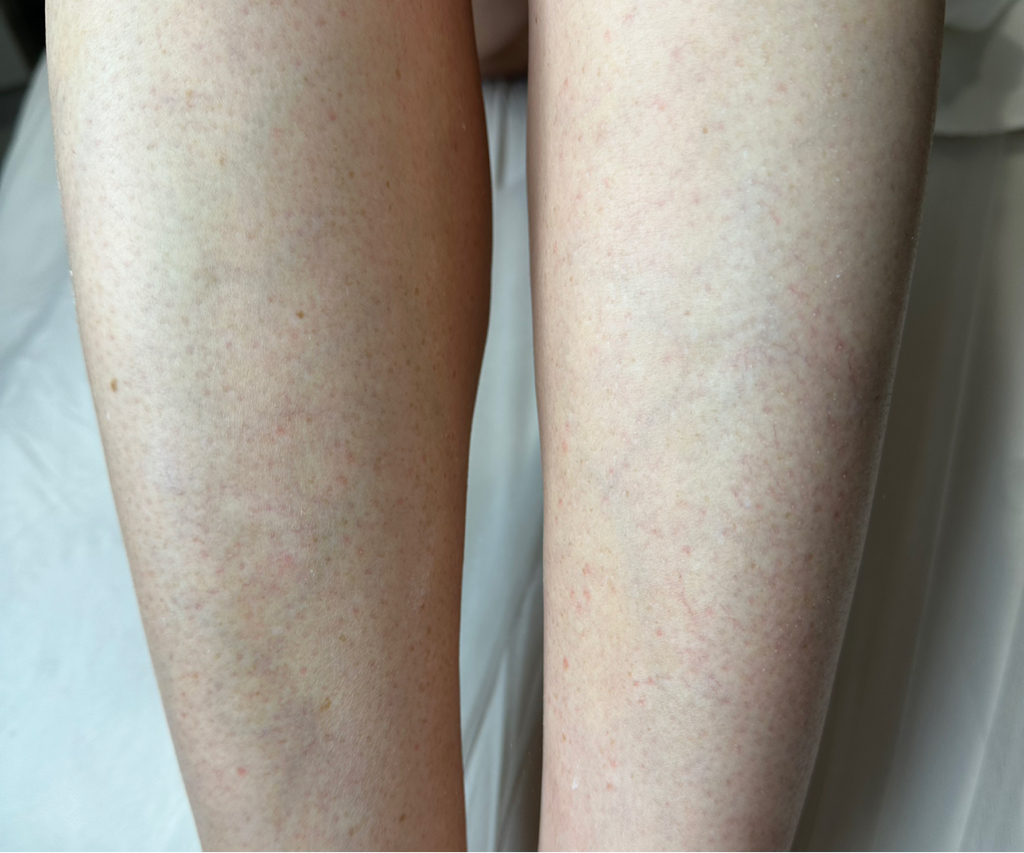 Ноги голени +( колени)