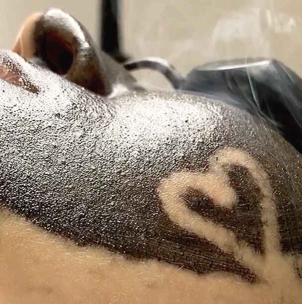 Карбоновый пилинг