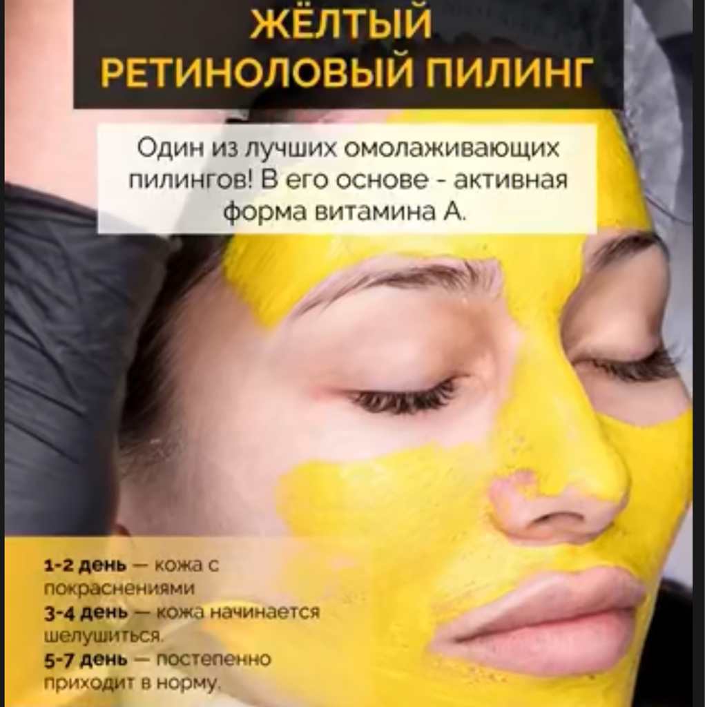 Желтый пилинг