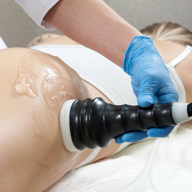 Вакуумный массаж «Лайт» - бедра, ягодицы и живот