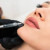 Lip filler treatments/Контурная пластика губ 1ml