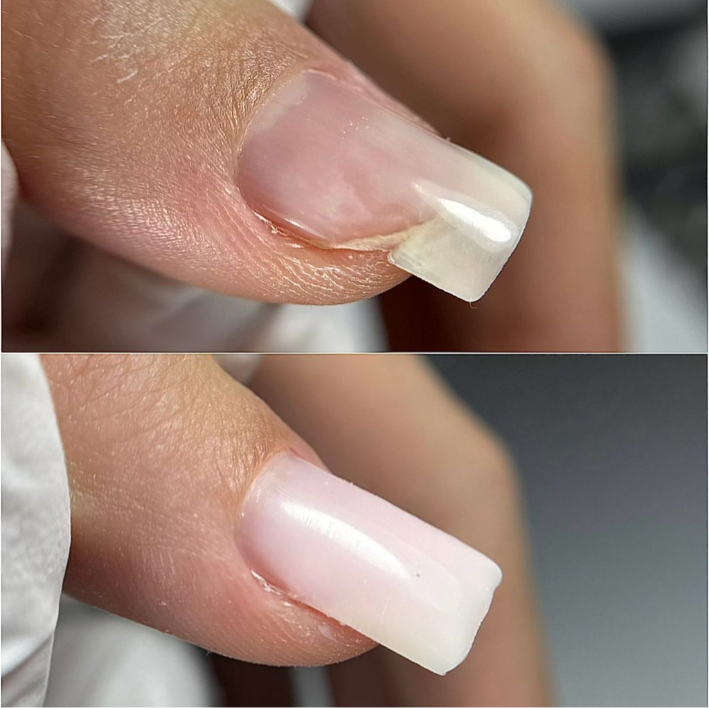 Ремонт ногтя