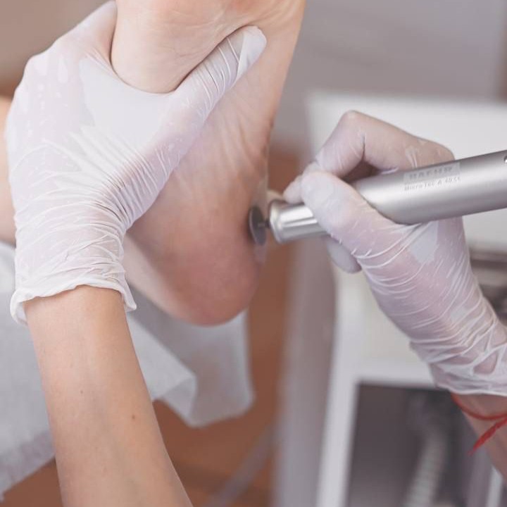 Комплекс 6. Снятие, smart-педикюр