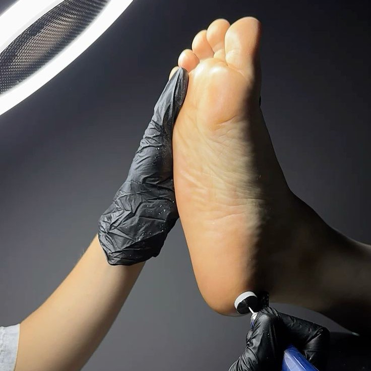 Обработка стоп SMART