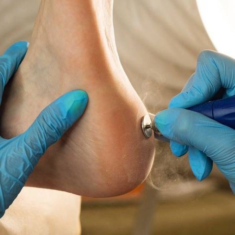 Комплекс 7. Снятие, smart-педикюр ( сложные стопы )