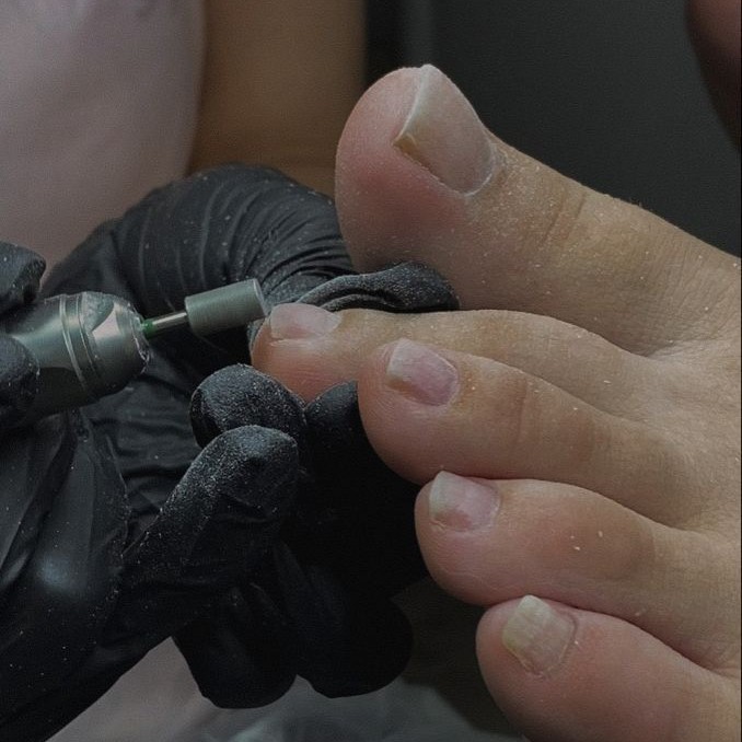 Педикюр ( пальчики)