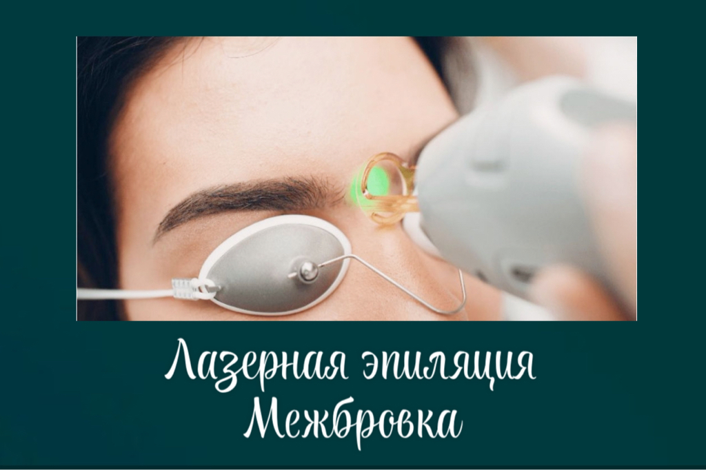 Межбровка