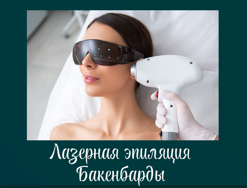 Бакенбарды