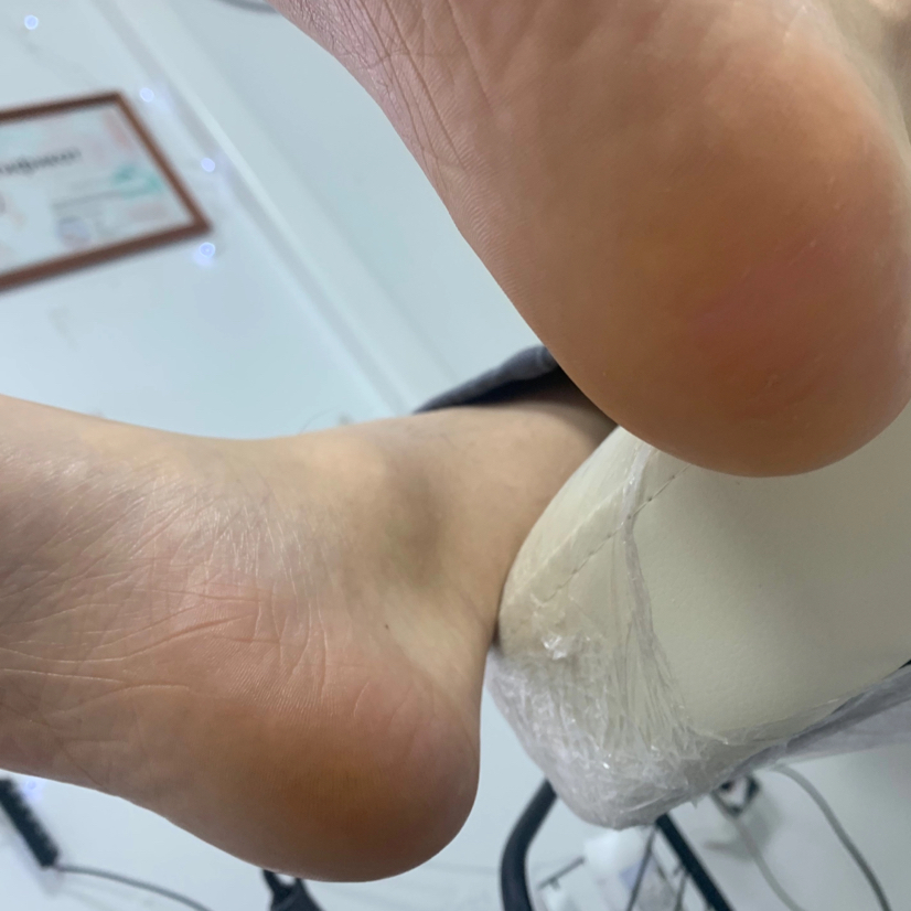 Обработка стоп