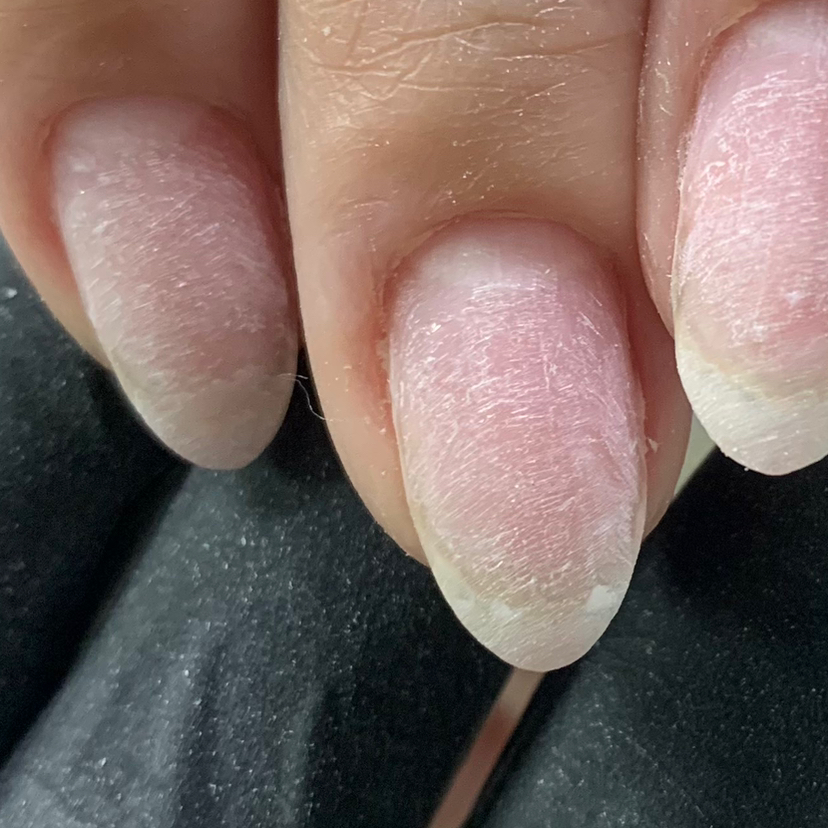 Снятие чужого покрытия