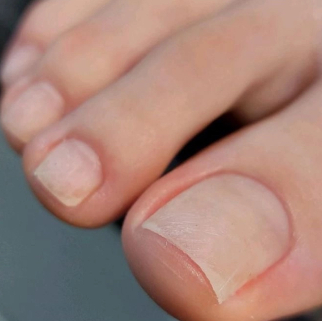 Педикюр пальчики