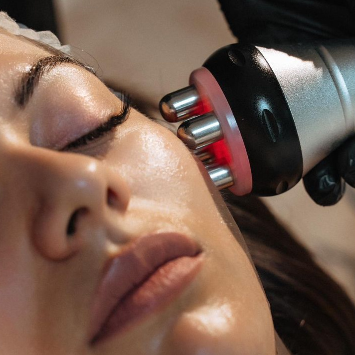 Rf-Lifting (лицо+шея)