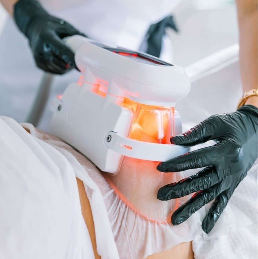 Криолиполиз 1 манипула