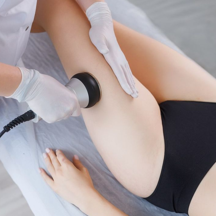 Вакуумный мaссaж с RF лифтингом (живот+бока)+ 1 зона кавитации