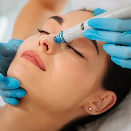 Вакуумная чистка лица