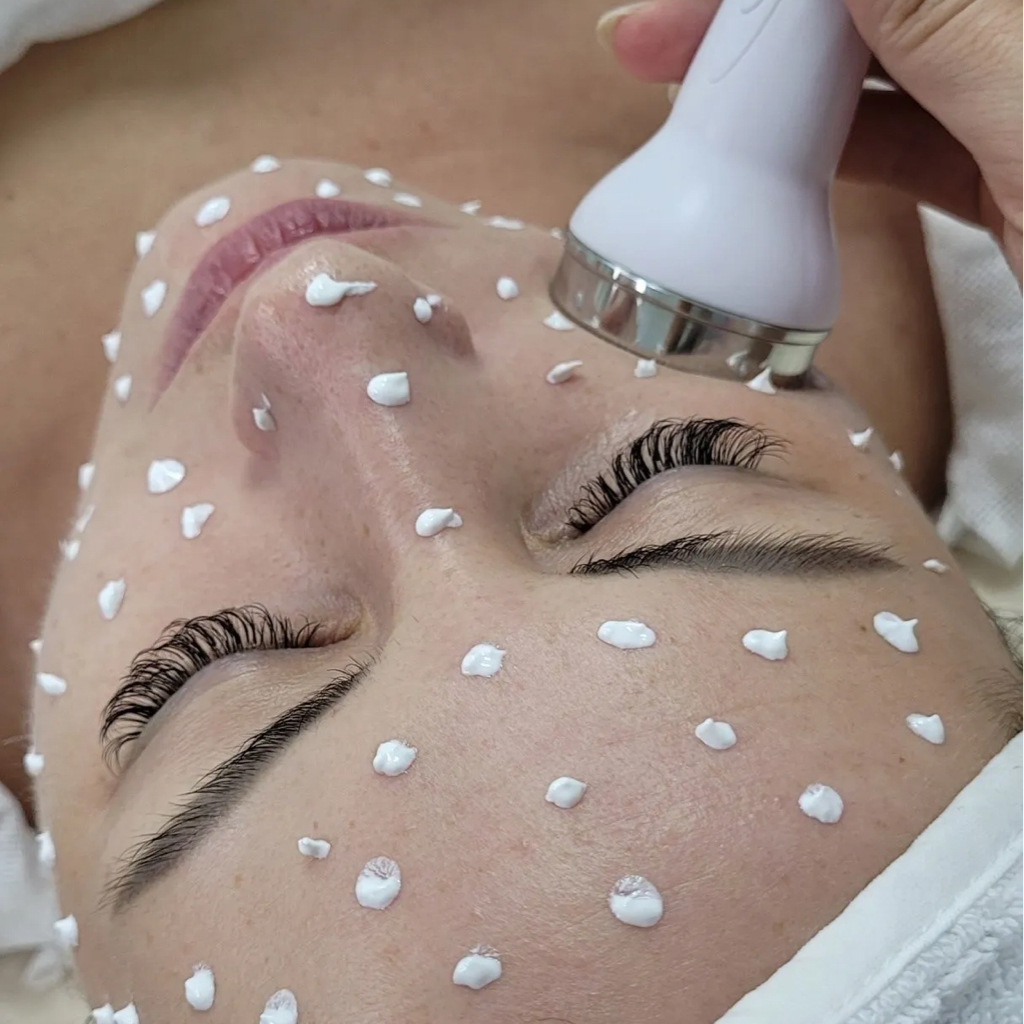 🔵ФАРФОРОВАЯ КОЖА (уз чистка, пилинг (на выбор), фонофорез, комплексный уход Angiopharm, альгинатная маска)