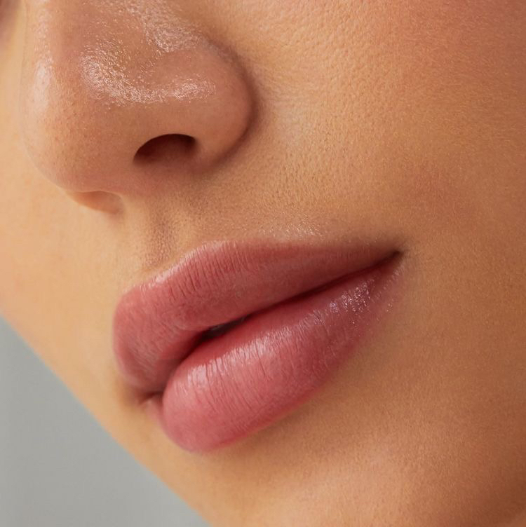 удаление пушкового волоса над верхней губой