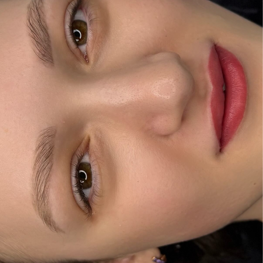 Межресничка