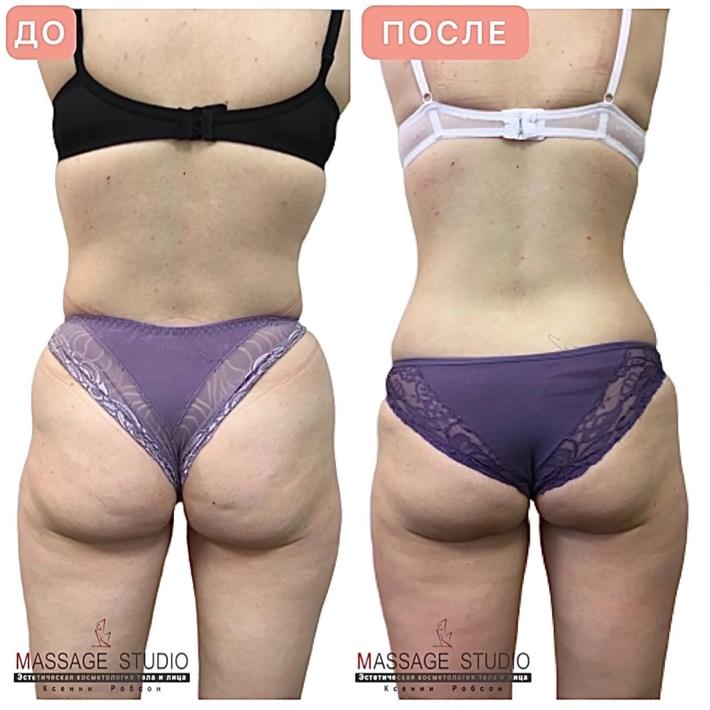 Моделирующий/контурный массаж тела 1,5часа