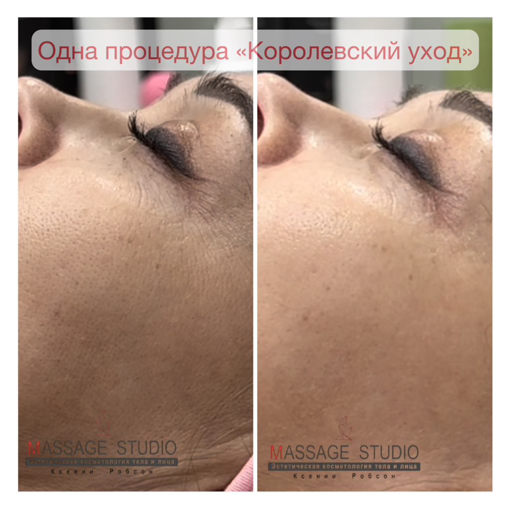 Королевский уход