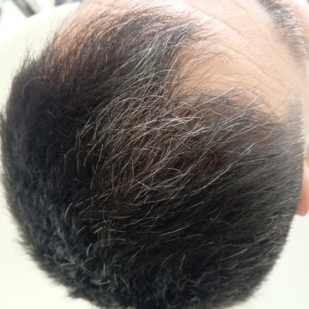 Комуфляж седины