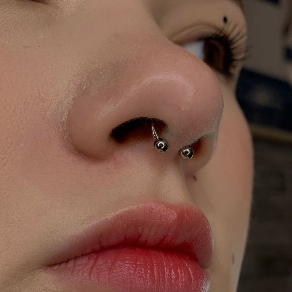 Септум циркуляр