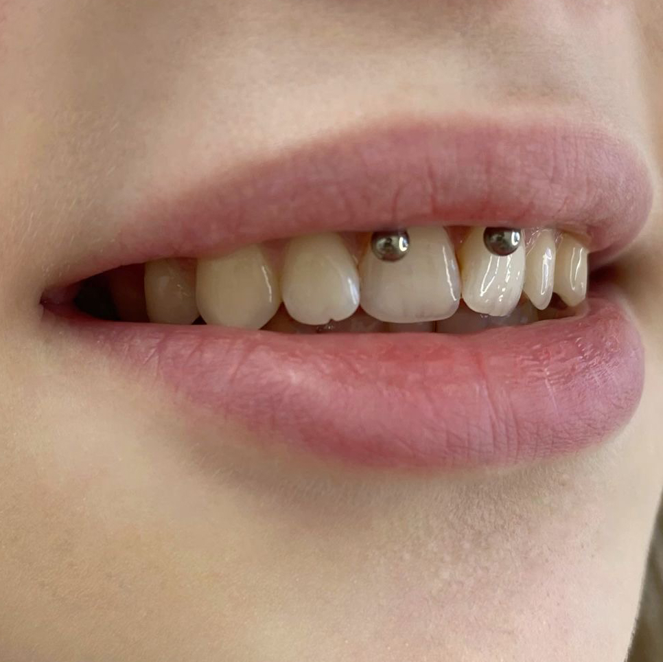 Смайл циркуляр